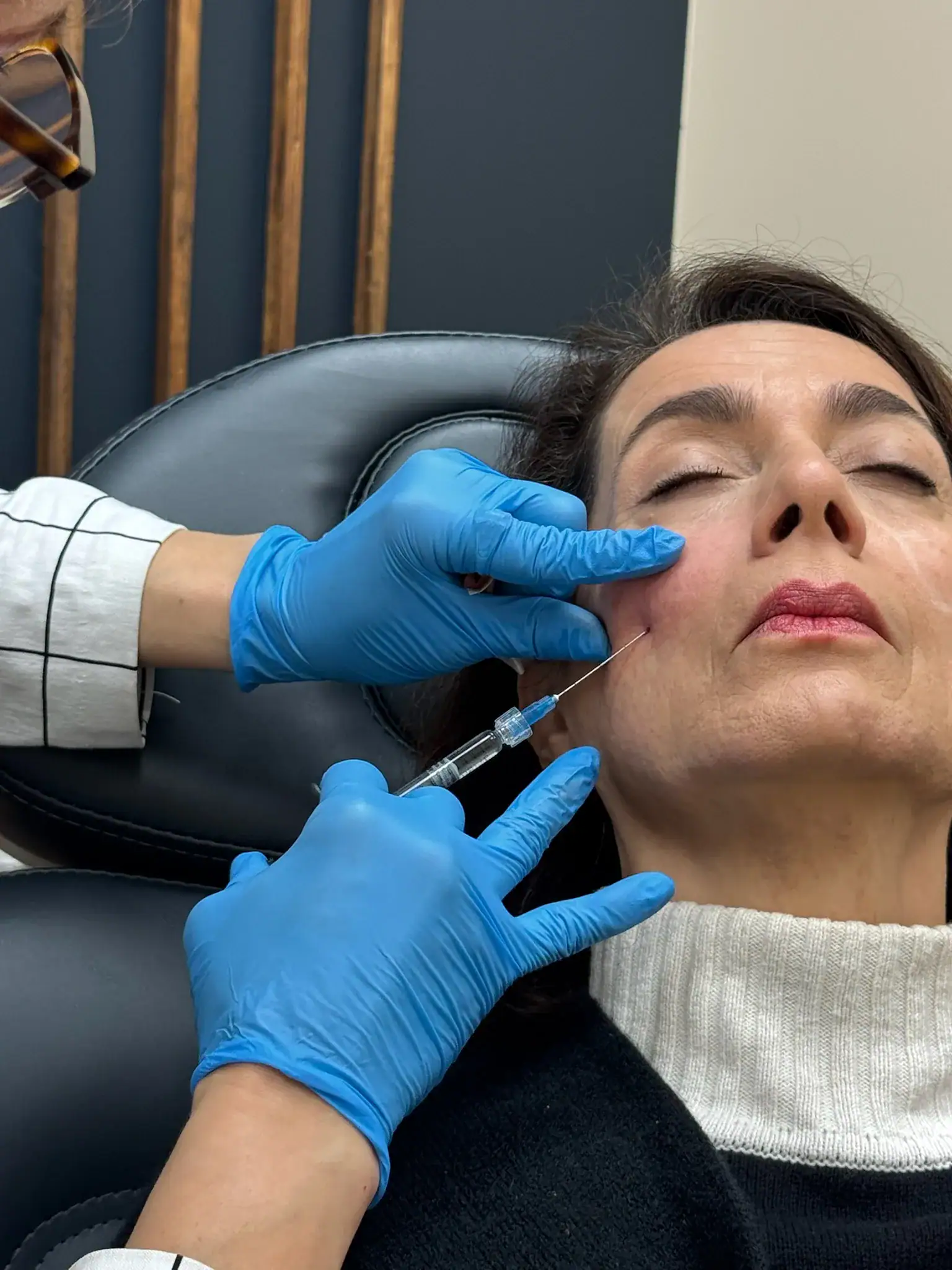 Person receiving dermal filler injection in clinical setting.